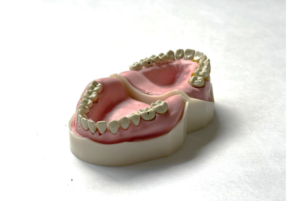 A Per se exportaron modelos 3D de dientes 4.0 ‘made in Colombia’